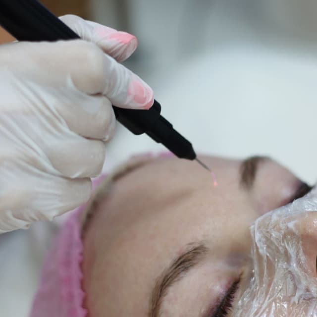 Cold Plasma Facial 3 treatments at BeautyProByJane in Valrico, FL